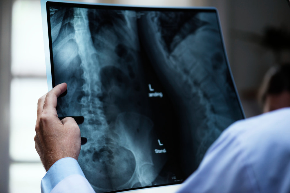 Ein Arzt hält das Röntgenbild einer Hüfte gegen Licht, um die Diagnostik von Hüftgelenkschmerzen durchzuführen