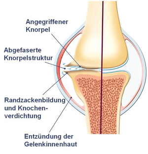 Zeichnung Kniegelenk