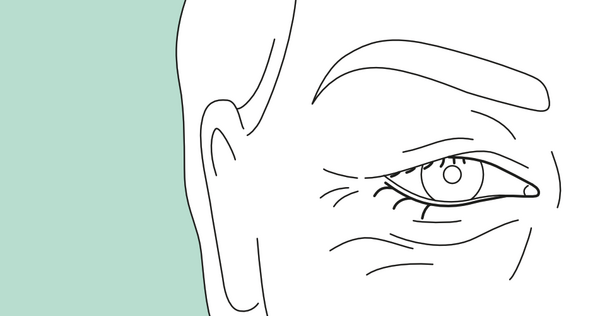 Hautüberschuss vor Lidstraffung