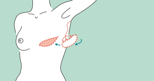 Schwenkung des Lappens