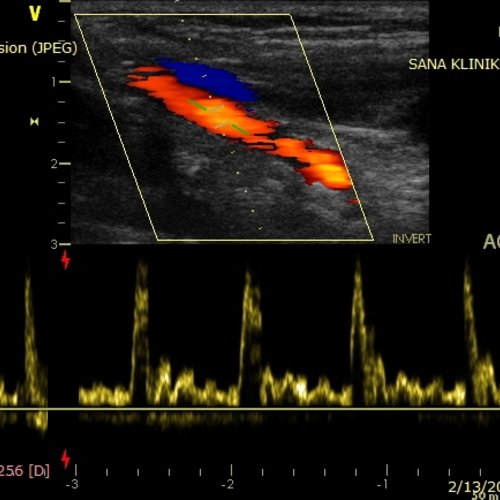 Angiologie