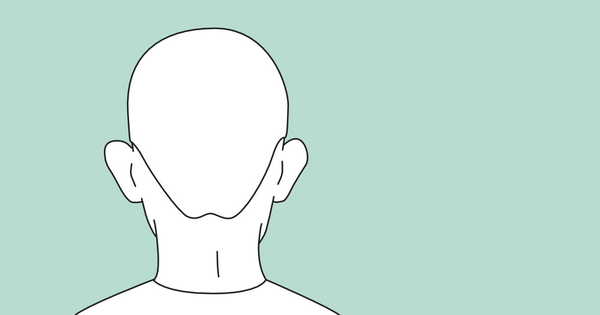 Abstehende Ohren Ansicht von Hinten