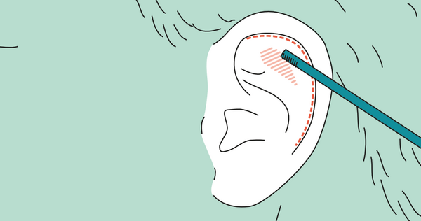 Schwächung des Knorpels