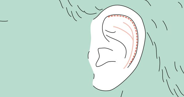 Bildung der Antihelixfurche