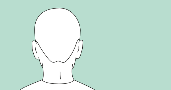 Ohrkorrektur Ansicht von Hinten