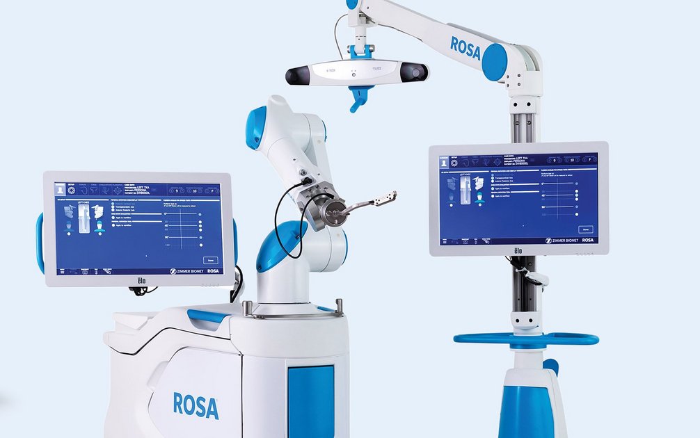Abbildung des ROSA-Roboters für robotergestützte Knieprothesen-OP