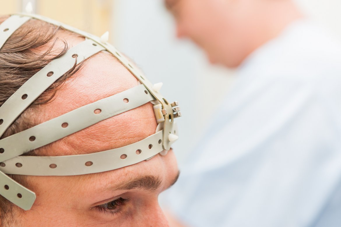Elektrode für EEG-Untersuchung Foto von einem Patient mit Elektroden für eine EEG-Untersuchung