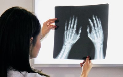 Ärztin betrachtet Röntgenbild der Hand