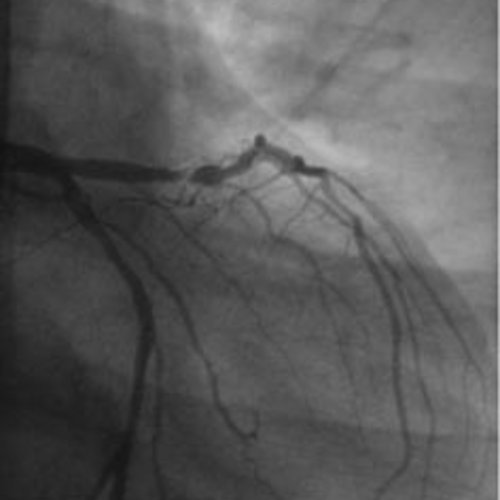 Kardiologie, Angiologie, Pneumologie & Intensivmedizin | Remscheid | Sana Kliniken AG