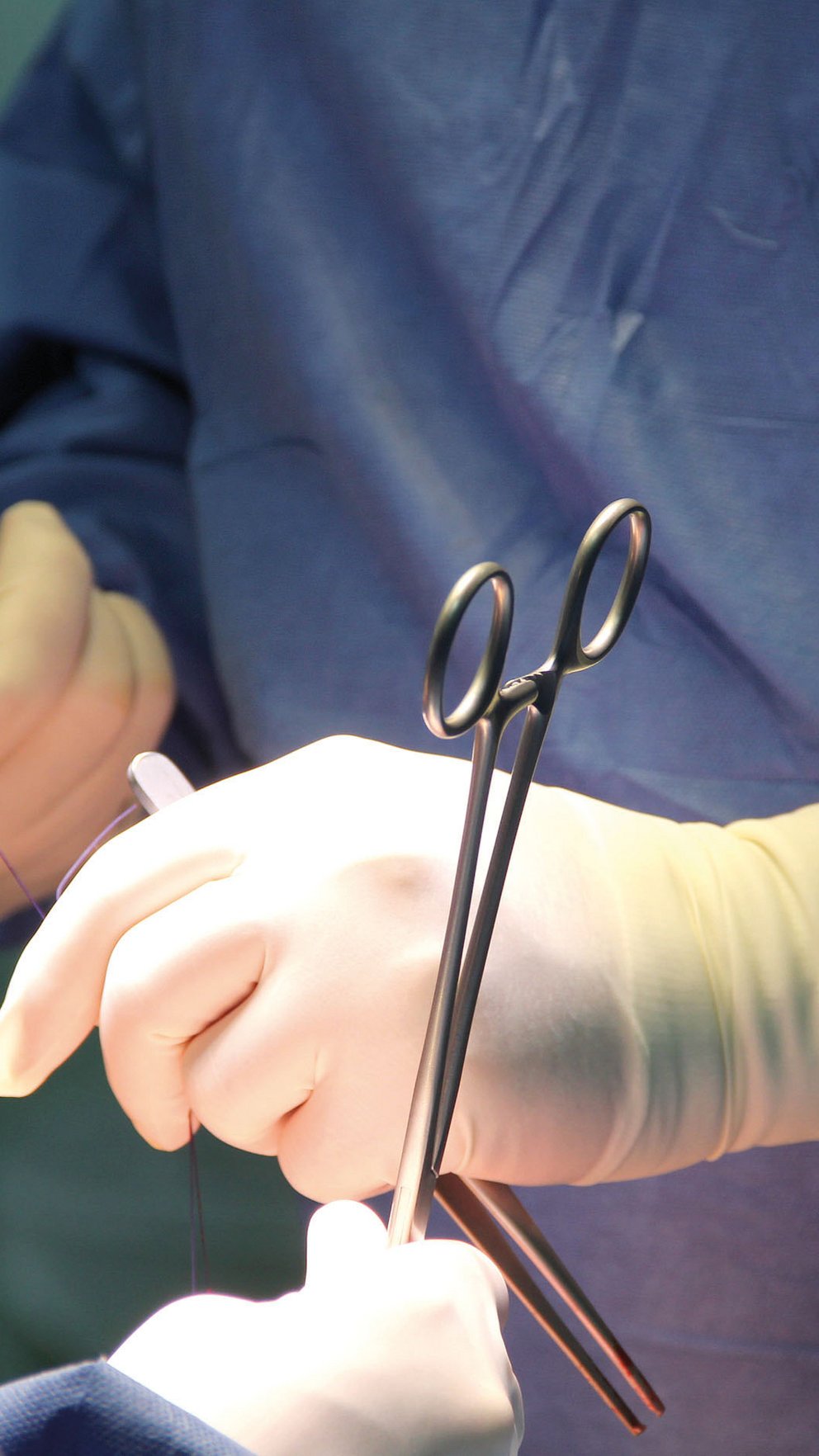 Arzthände bei einer Operation