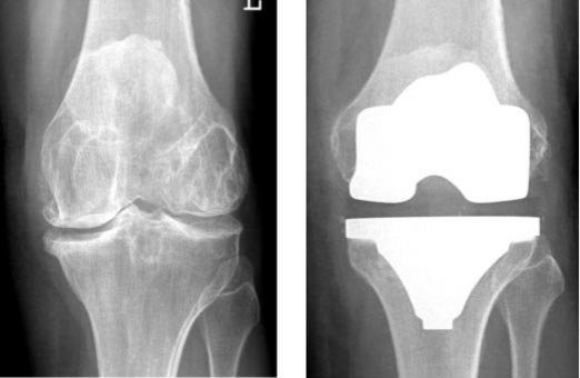Arthrose Navigation