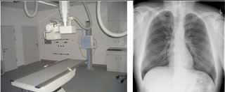 Konventionelle Röntgendiagnostik