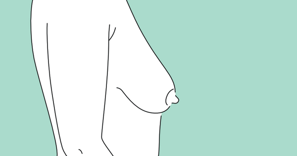 Zustand vor Straffung