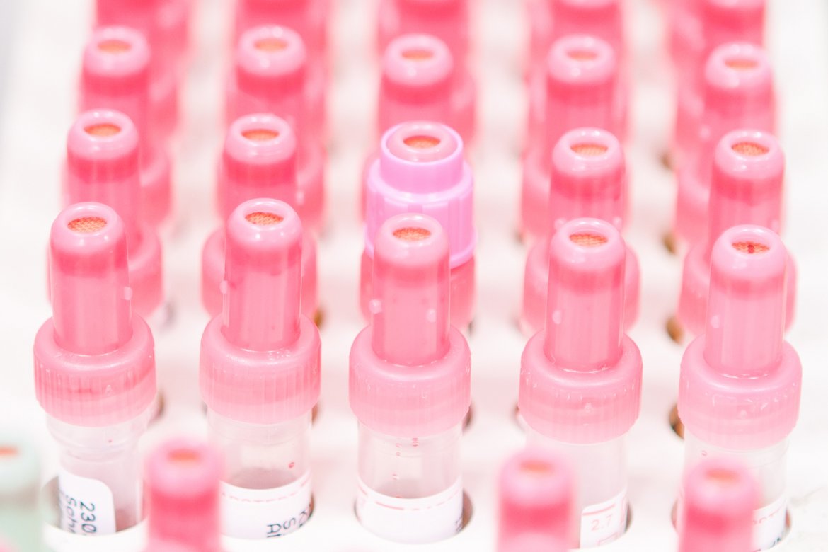 Monovetten im Zentrallabor Foto von mehreren Monovetten für Blutanalysen im Zentrallabor