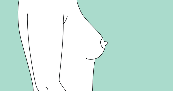 Zustand nach Straffung