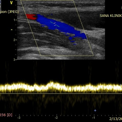 Angiologie