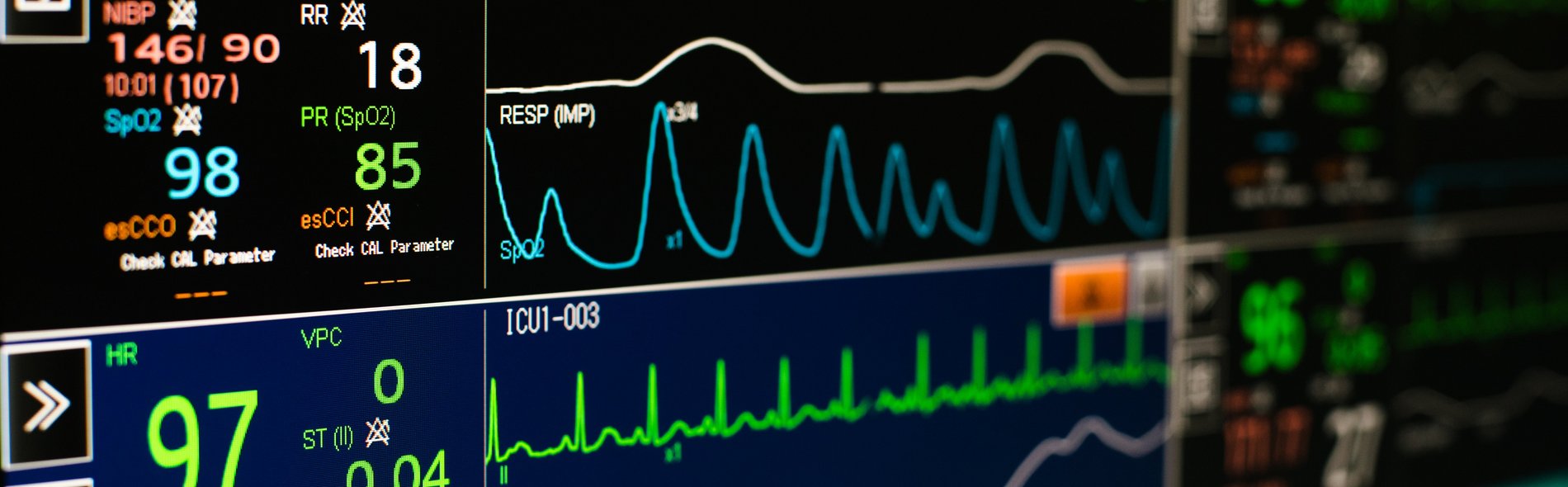 Monitoring Herzmedizin