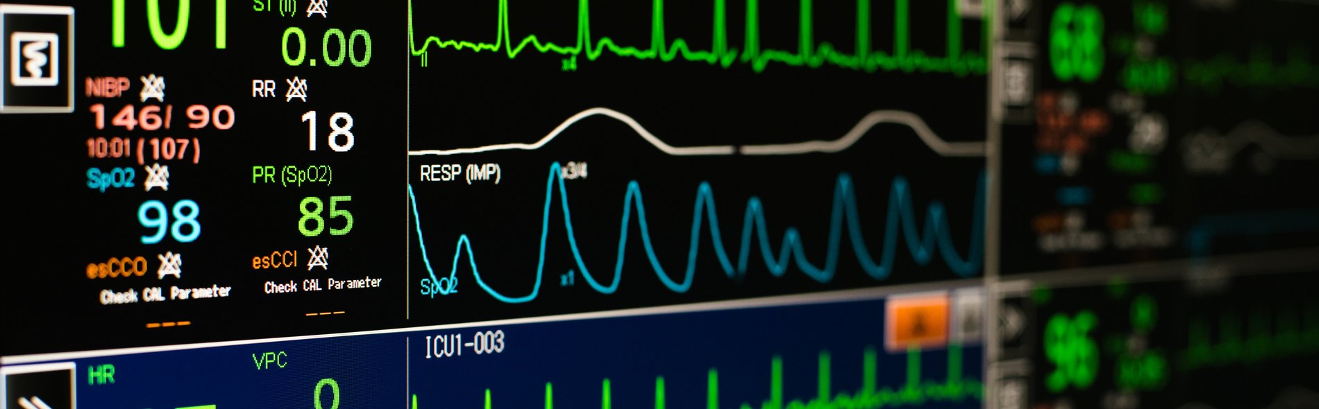 Monitoring Herzmedizin