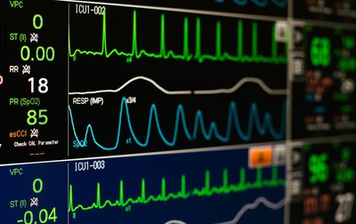 Monitoring Herzmedizin