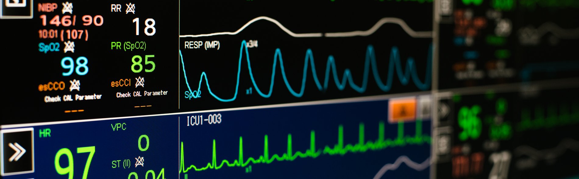 Monitoring Herzmedizin