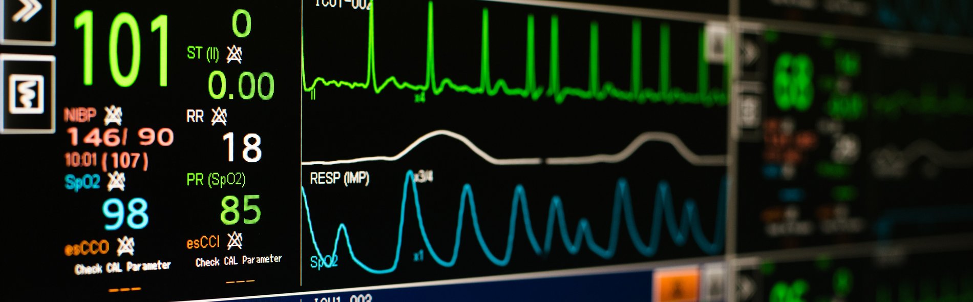 Monitoring Herzmedizin