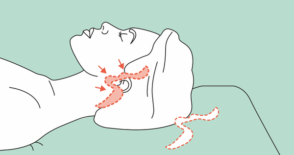Resektion der überschüssigen Haut