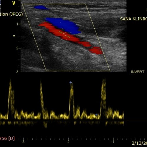 Angiologie